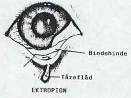 Ektropion